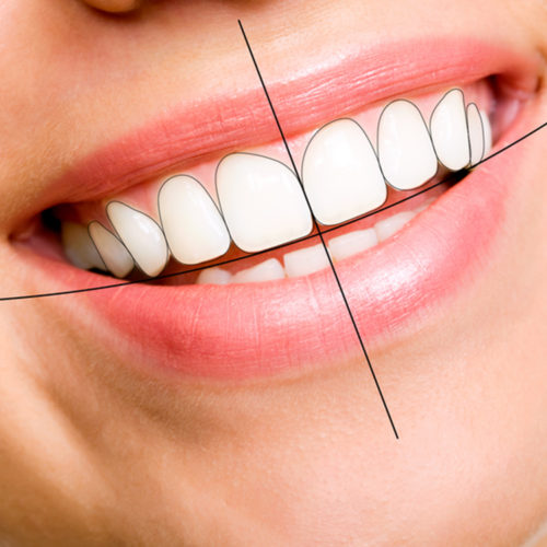 Smile Design