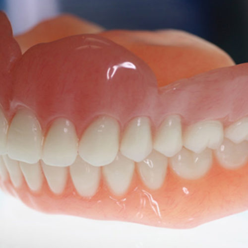 Prosthetic Dentistry