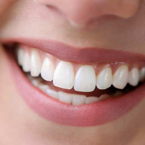 Zirconium Crowns