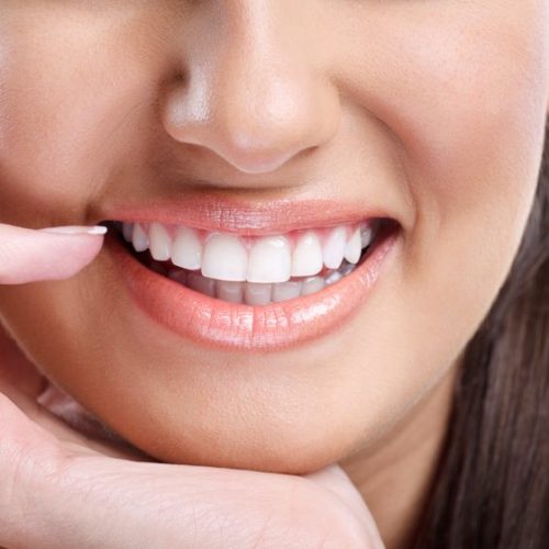 Aesthetic Fillings (Composite)